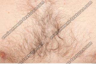 photo texture of hairy skin 0003